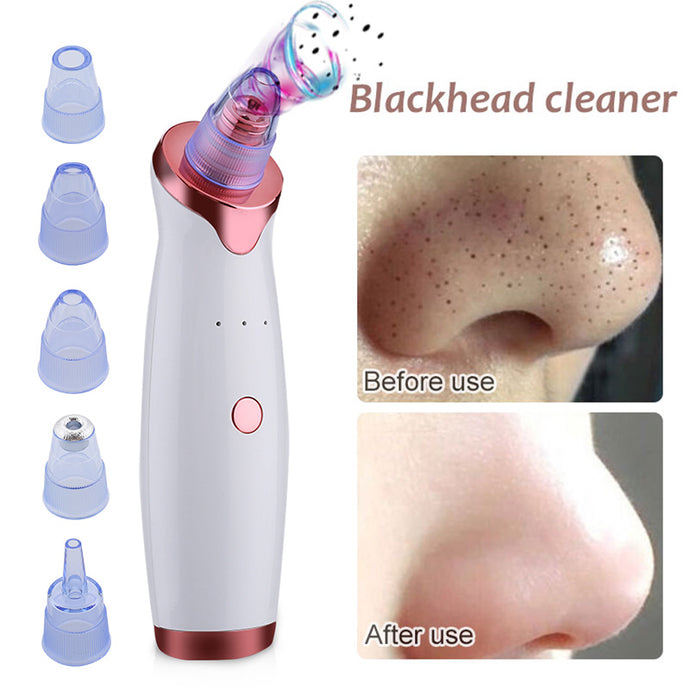 Electric Blackhead Remover™